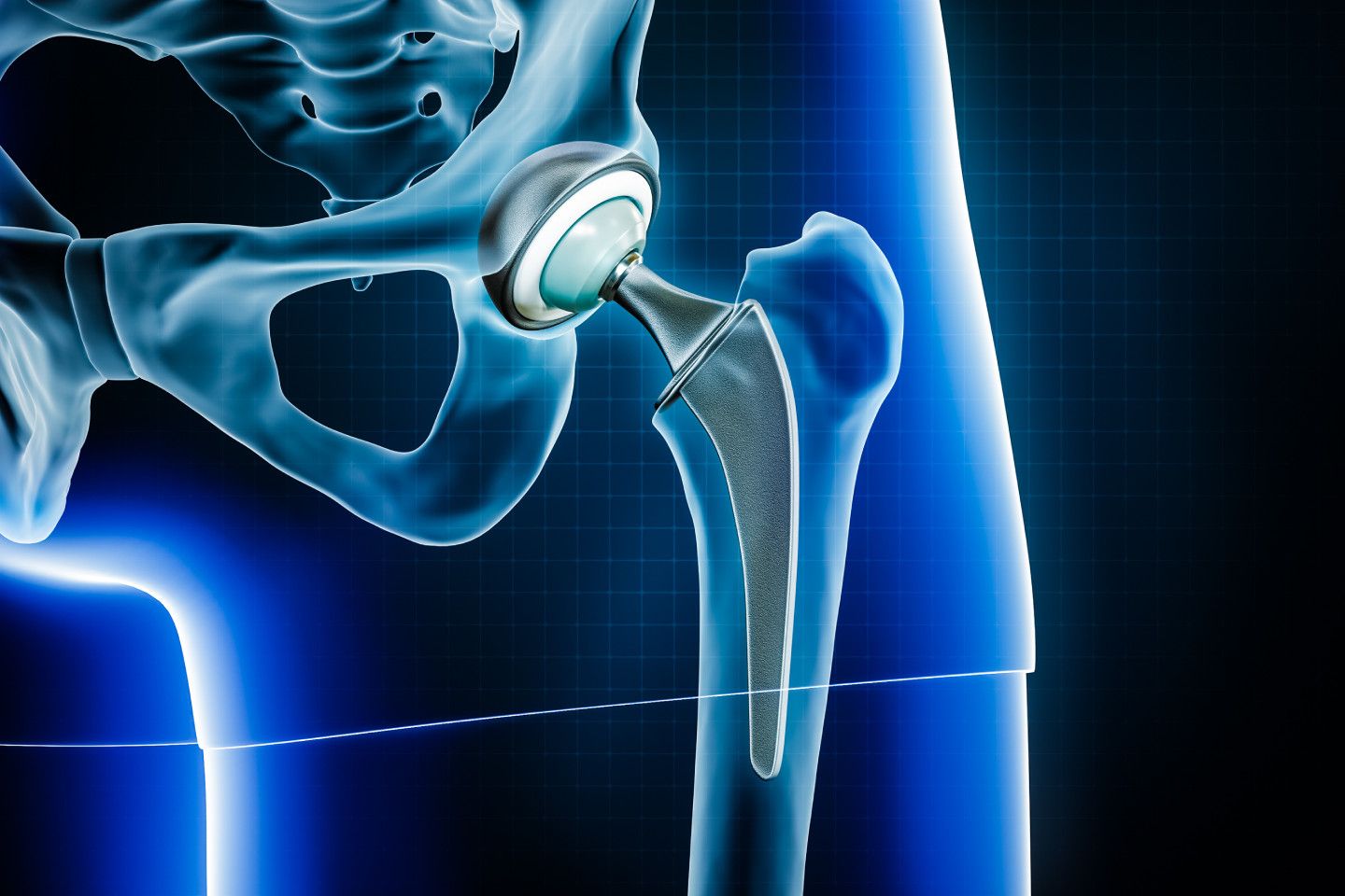 When Should You Visit a Hip Replacement Surgeon in Jaipur During Winter? A Complete Patient-Friendly Guide