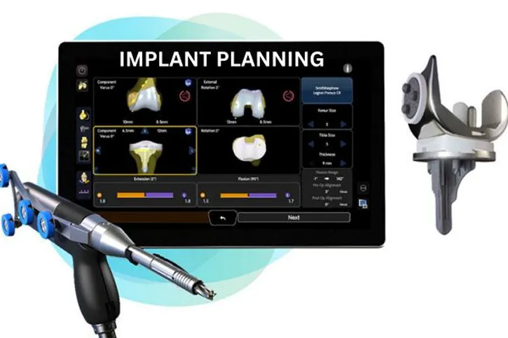 Knee Replacement Doctors